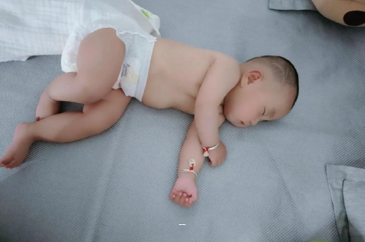 嘉峪关宝宝脸上有白色斑块